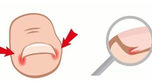      ����Ƥ��ҽԺ���Ƽ׹���-֢״