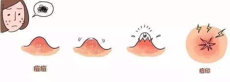 ����Ƥ��ҽԺҽʦ�|ȥ��ӡ