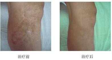 �̺��޸�����Ƥ��ҽԺ�ļҺ�