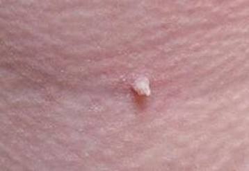 �촽�ϳ�Ѱ������ô�죿