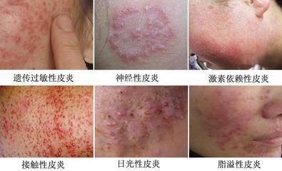 ���ݻ��н���Ƥ�׵�&ldquo;8��&rdquo;����