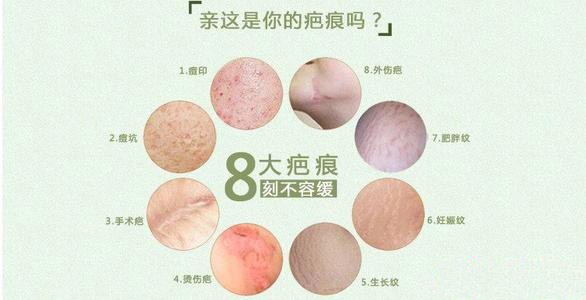 �̺۵�����-����רҵȥ�̺۵�Ƥ����ҽԺ