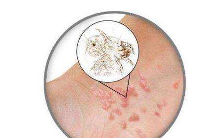 �괯-���ݿ��괯��Ƥ��ҽԺ