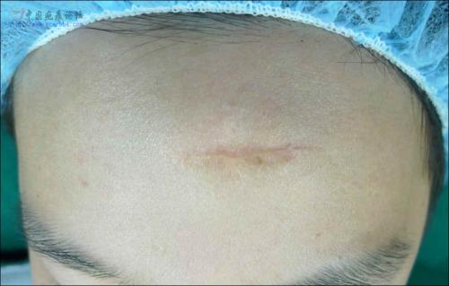 ����Ƥ����:��̺۵��������� רҵҽԺ������