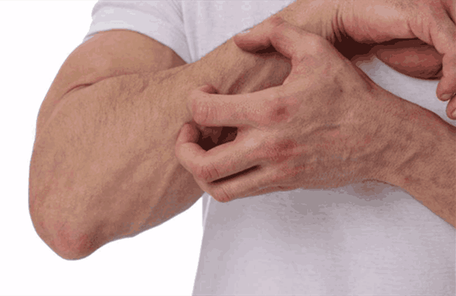 �ﶬ��Ƥ��������������ô��?����Ƥ����ҽԺ���η���