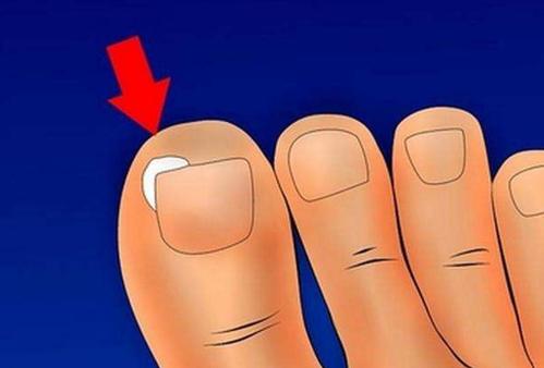 ����׹��׵�ԭ������Щ��ƽ��Ҫע�������ֻ�ϰ��